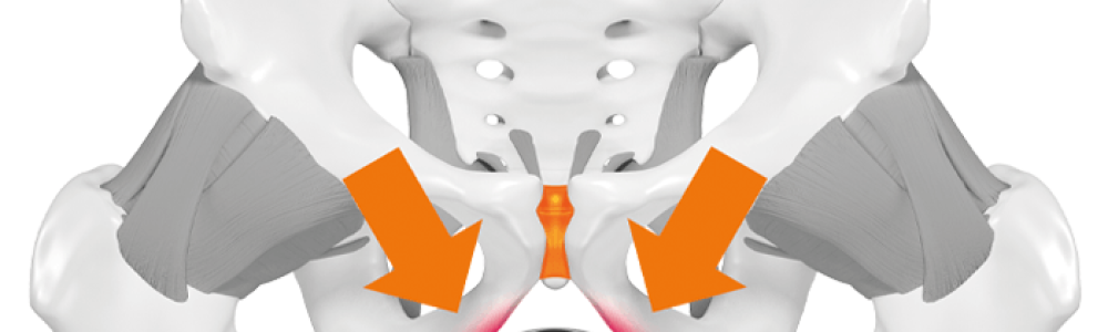 sqlab.Bild.becken.zu.schmal.010.Rigged.Bones.Skin.700x800